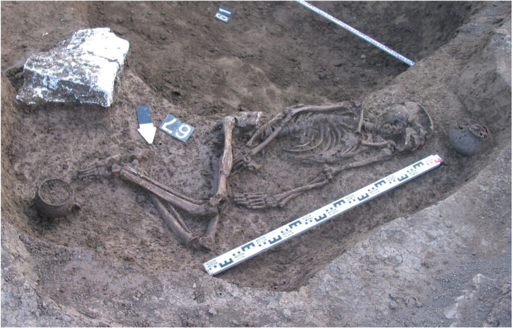 Fotografie eines Grabs. Das Skelett des, an einer Seltenen Krankheit leidenden, Mannes, mit leicht angewinkelten Beinen ist sehr gut erhalten. In der Mitte des rechten Oberschenkels ist eine Fraktur zu erkennen. Als Grabbeigaben wurden zwei Gefäße deponiert.